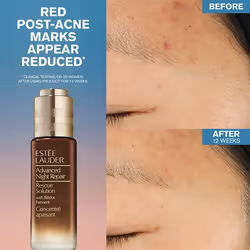 Estée Lauder Advanced Night Repair Rescue Solution Serum with 15% Bifidus Ferment Sérum visage 20 ml Femmes