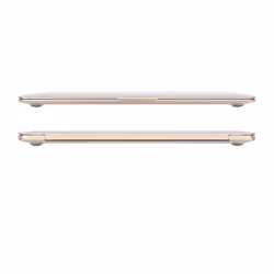 Moshi iGlaze 30,5 cm (12") Boîtier robuste Transparent - Vue supplémentaire 2